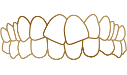 Generally Straight Teeth